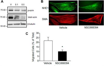 Hypoxia enhances interactions between Na+/H+ exchanger isoform 1 and actin filaments via ezrin in pulmonary vascular smooth muscle